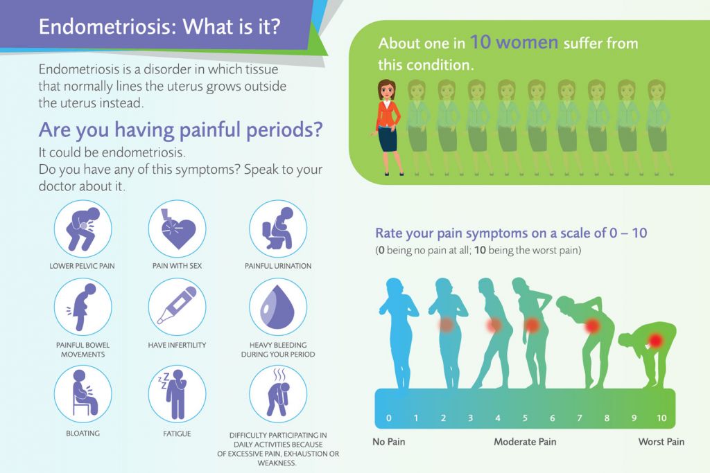 Endometriosis Information Myendosis